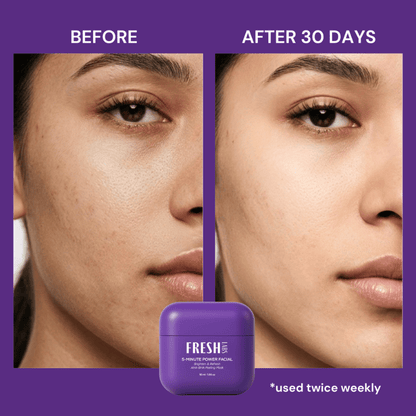 FreshLabs 5-Minute Power Facial Mask, 50ml