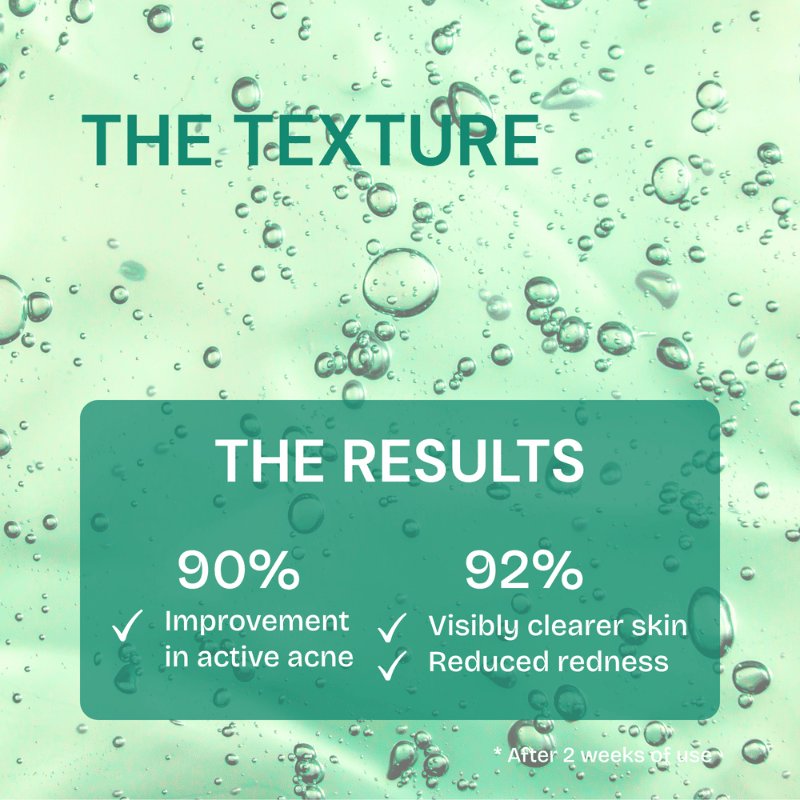 FreshLabs Breakout Rescue Acne Serum, 30ml