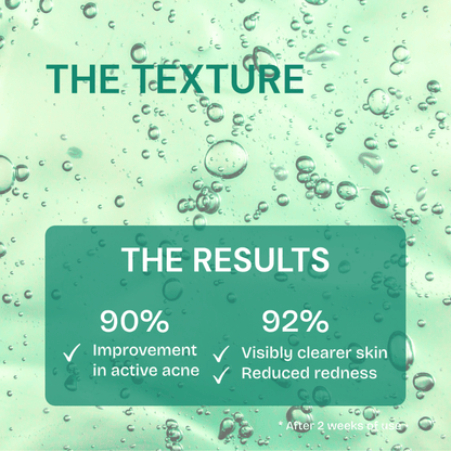 FreshLabs Breakout Rescue Acne Serum, 30ml