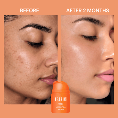FreshLabs Magic Glow 15% C Serum, 30ml